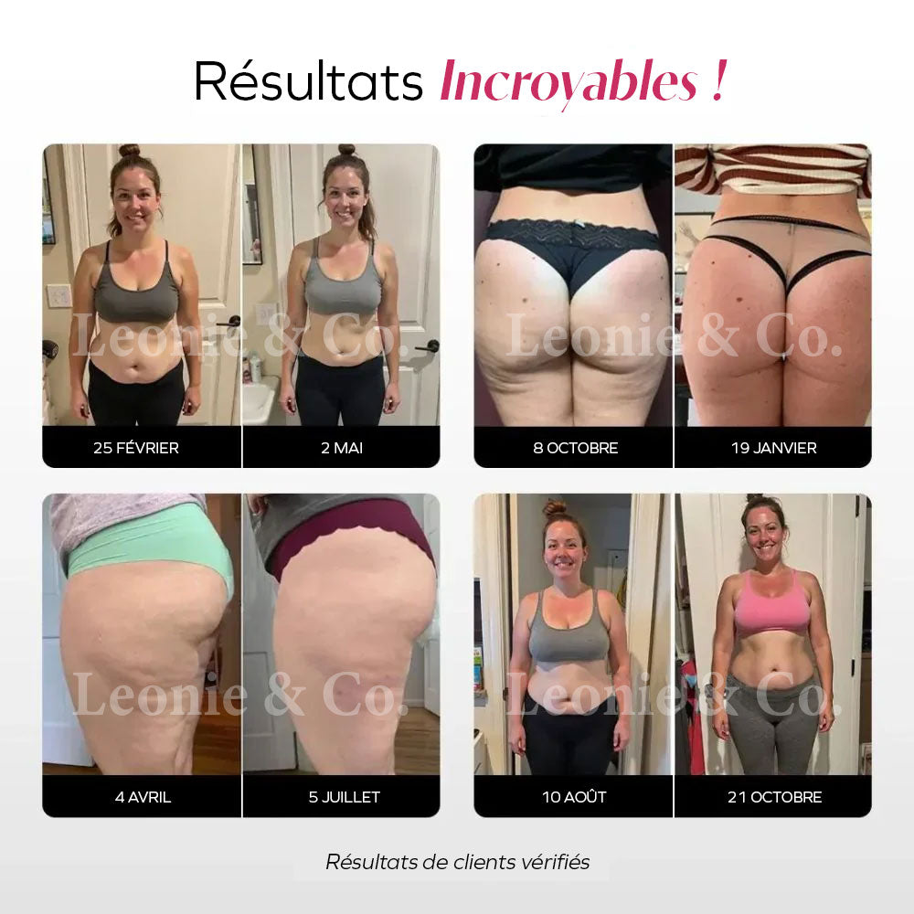 Tlaquepaque™ Leggings 3D Anticelulíticos con Compresión Suave